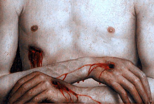 old wound(s)