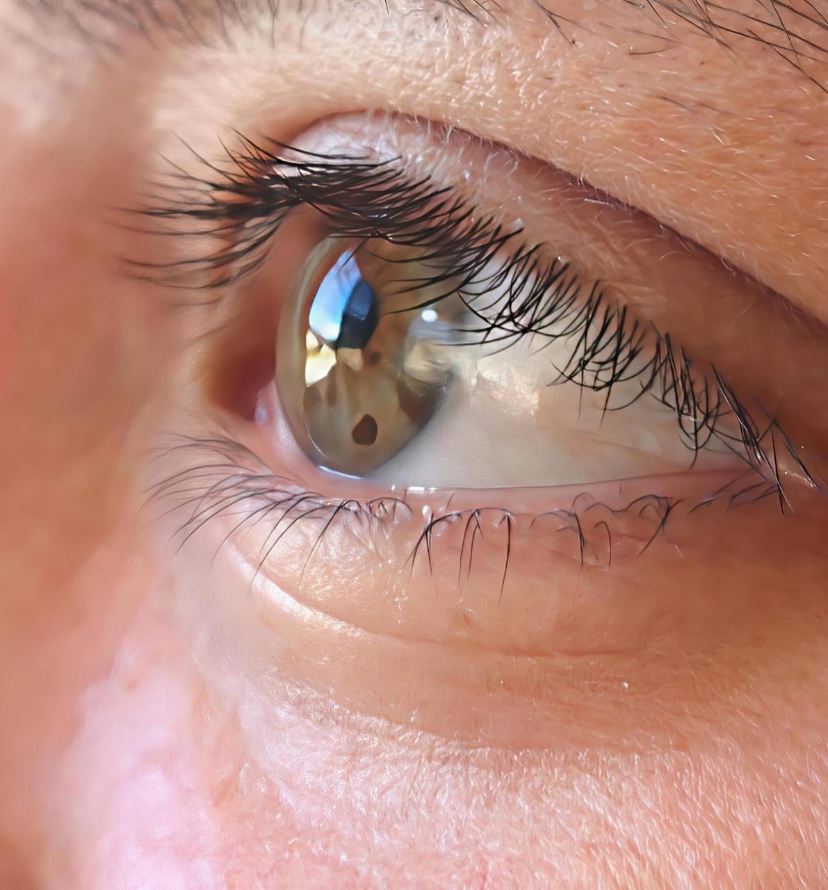 La resiliencia de mis facetas 