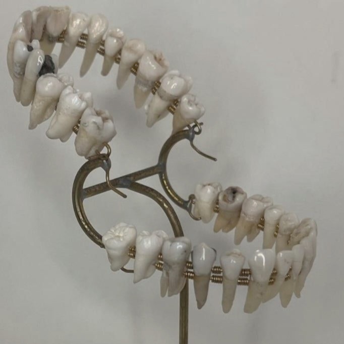 Ojalá se me caigan el resto de mis dientes